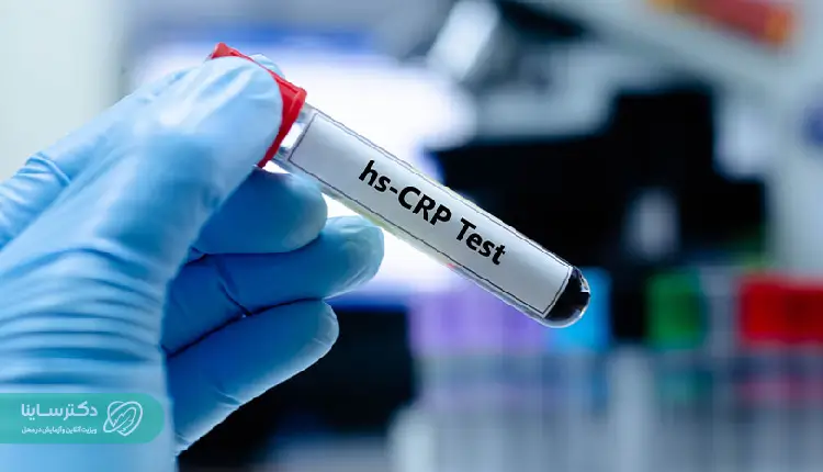 آزمایش hs-CRP