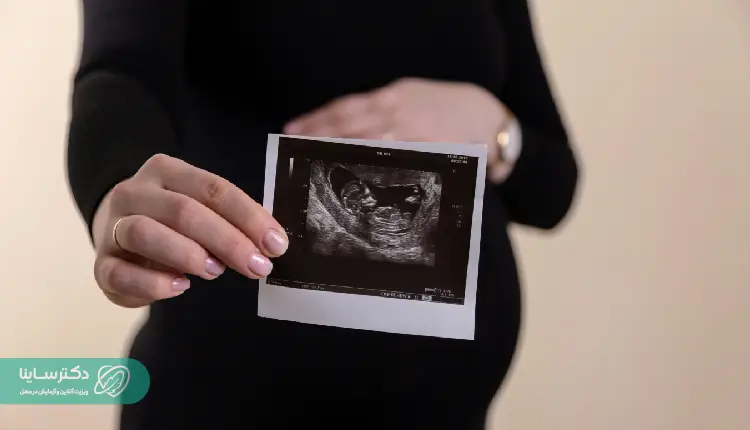 A pregnant woman holding an ultrasound image, highlighting the importance of prenatal screenings such as the MCH test during pregnancy