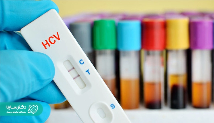 آزمایش HCV