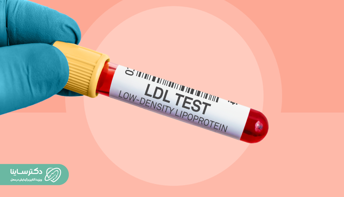 آزمایش LDL