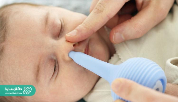 استفاده از ساکشن ملایم برای پاکسازی مجرای بینی نوزاد در هنگام گرفتگی بینی