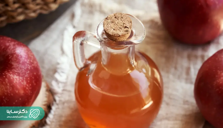 سرکه سیب برای دفع سنګ کلیه