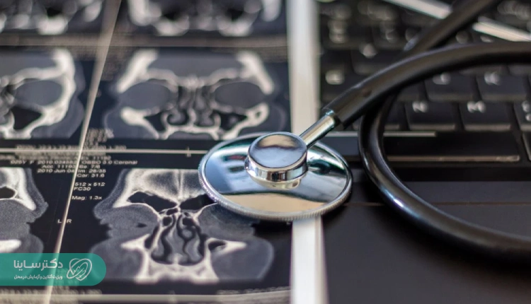 ct-scan-nose-sinus