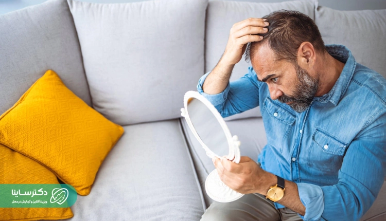 ریزش مو از علائم پایین بودن پروژسترون در آزمایش مردان