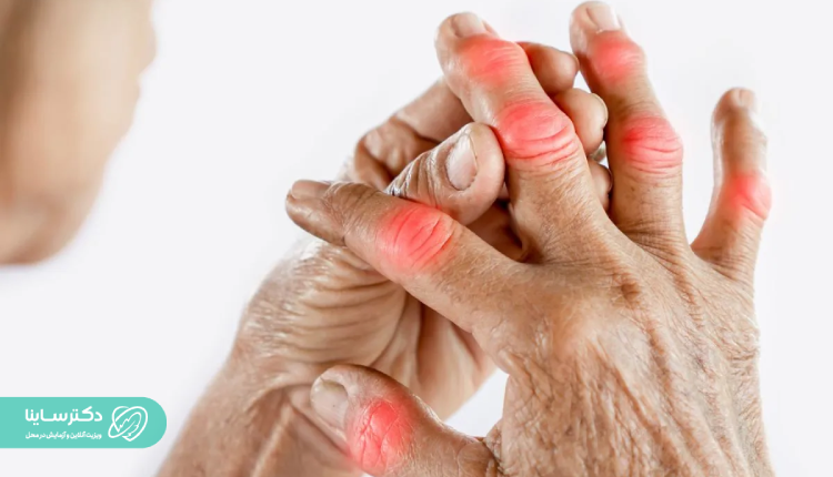 علائم MCHC پایین