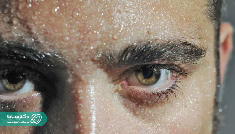 علت عرق زیاد سر و صورت