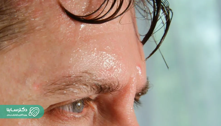 دلایل تعریق زیاد سر و صورت