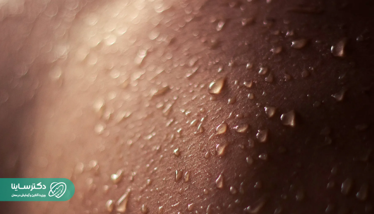 علائم و نشانه‌های تعریق غیرطبیعی سر و صورت