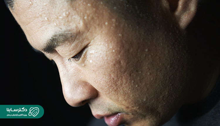 روش‌های تشخیص تعریق زیاد