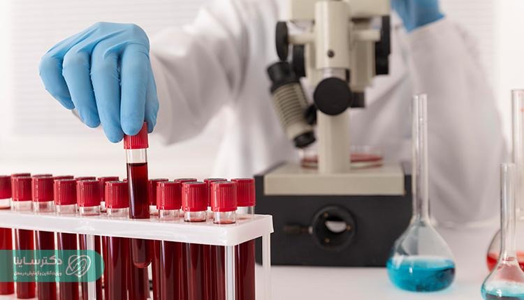 آزمایش خون تیروئید پرکار 