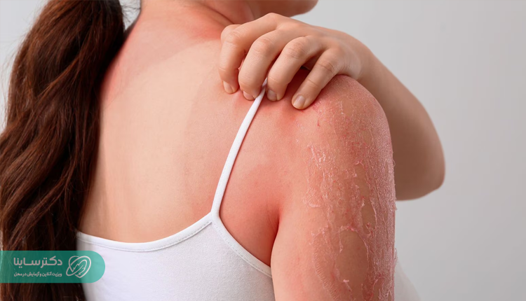 دلایل تورم غدد لنفاوی گردن: از عفونت تا سرطان